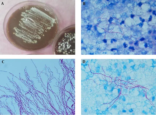 Actinomyces and Nocardia: Culture and Microscopic Morphology