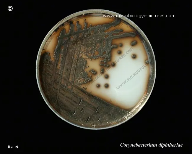 Corynebacterium diphtheriae on Tinsdale agar