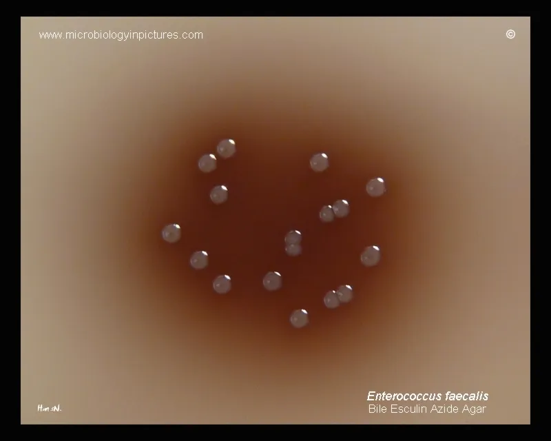Enterococcus faecalis on Bile Esculin Azide Agar