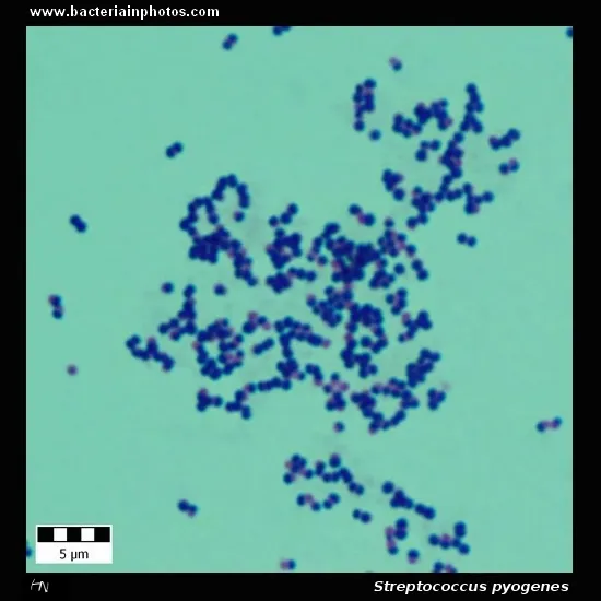 Streptococcus pyogenes: Gram-positive cocci in chains