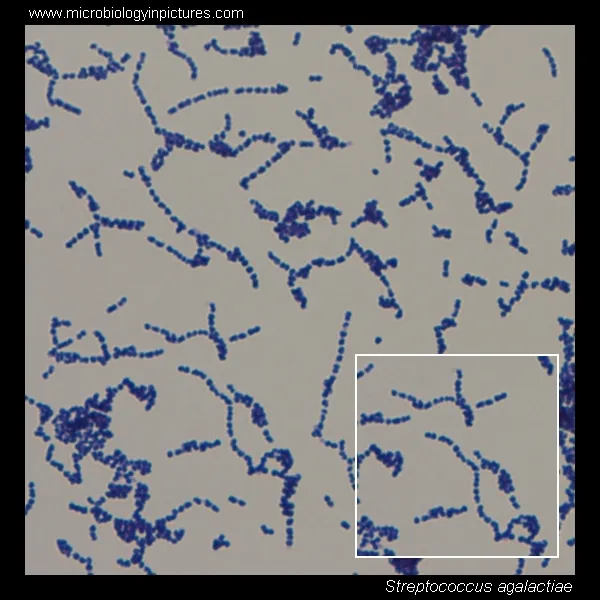 Streptococcus agalactiae: Gram-positive cocci in chains
