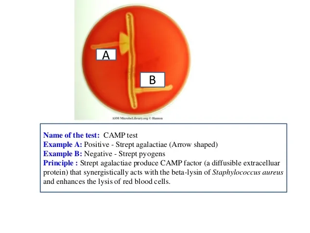 CAMP test for Group B Streptococcus (S. agalactiae)