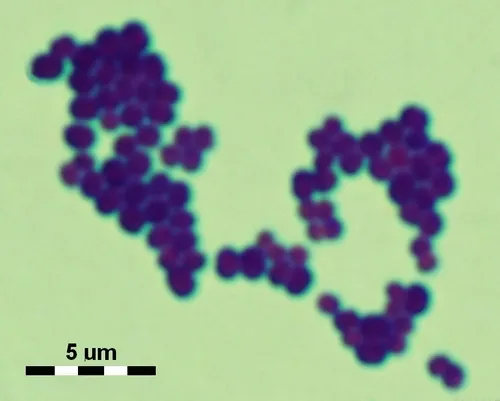 Staphylococcus aureus Gram stain, grape-like clusters
