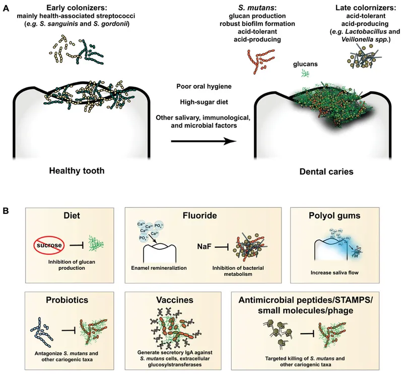 Dental caries pathogenesis and prevention strategies