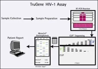 TruGene HIV-1 Assay Workflow