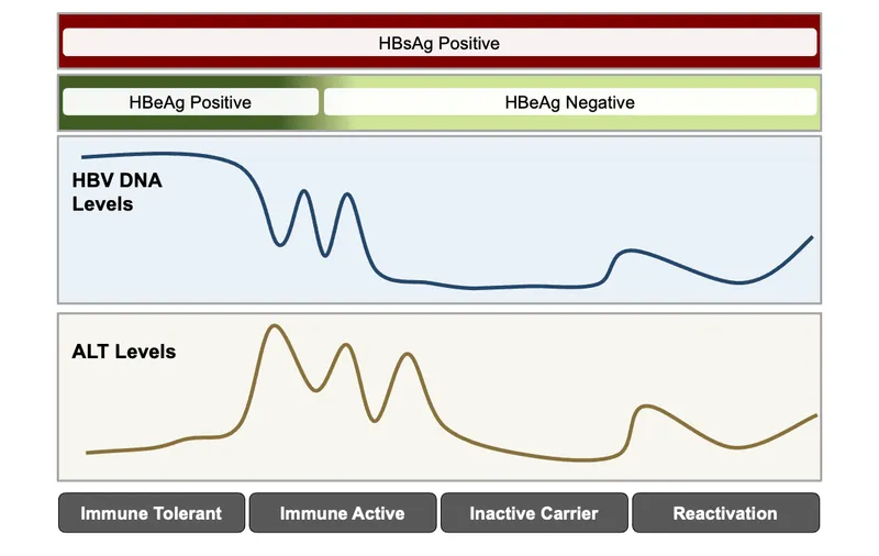 Chronic Hepatitis B Phases: Serology and ALT Levels