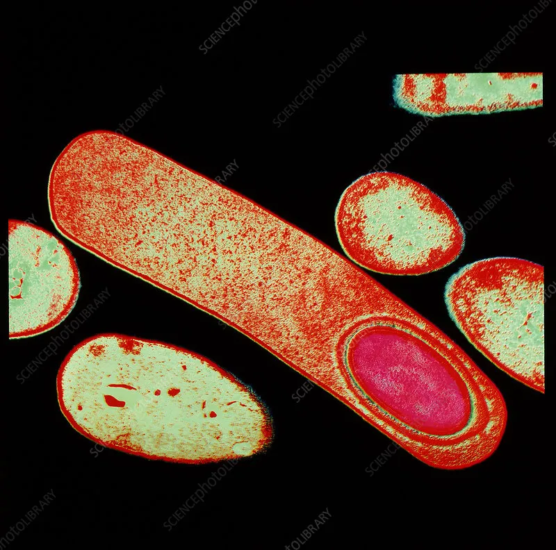 Clostridium difficile bacterium with endospores