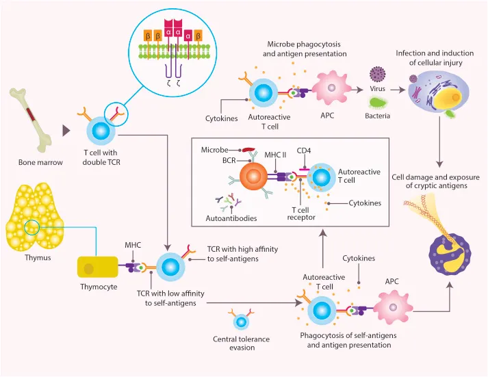 Mechanisms of Autoimmunity