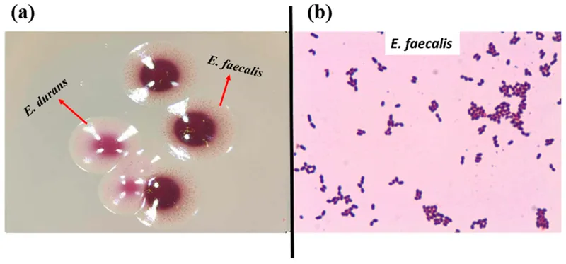 E. durans and E. faecalis culture and Gram stain