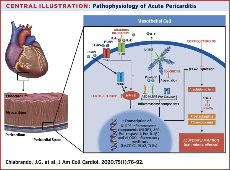 Pathophysiology of Acute Pericarditis