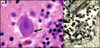 Negri bodies and rabies virions