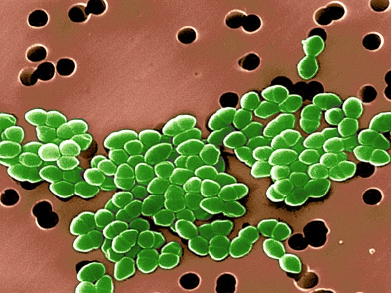 SEM of Vancomycin-Resistant Enterococci (VRE) bacteria