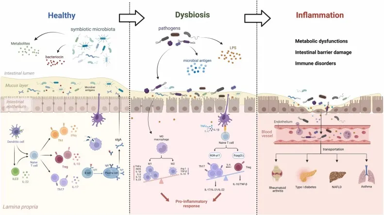 Gut Dysbiosis and Inflammation Diagram