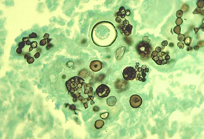 Coccidioides immitis spherules with endospores