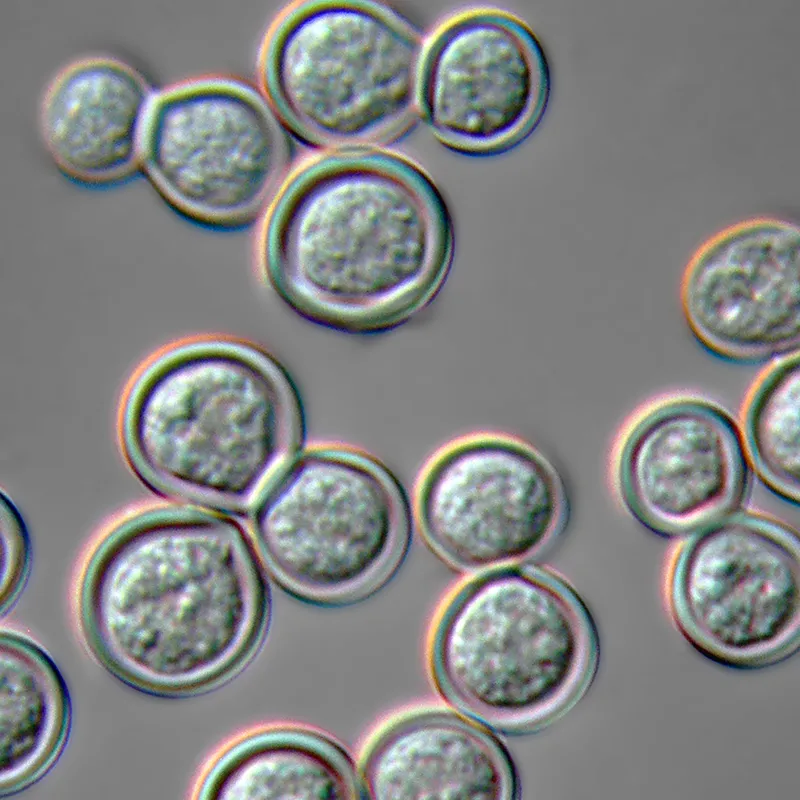 Blastomyces dermatitidis broad-based budding yeast