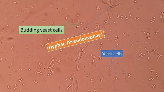Microscopy of budding yeast and pseudohyphae