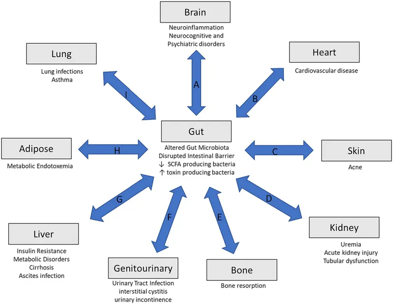 Gut Dysbiosis and Systemic Health Effects Diagram