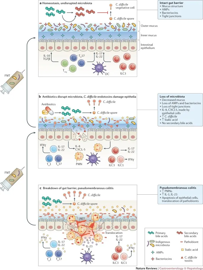 C. difficile infection: Microbiome disruption and FMT