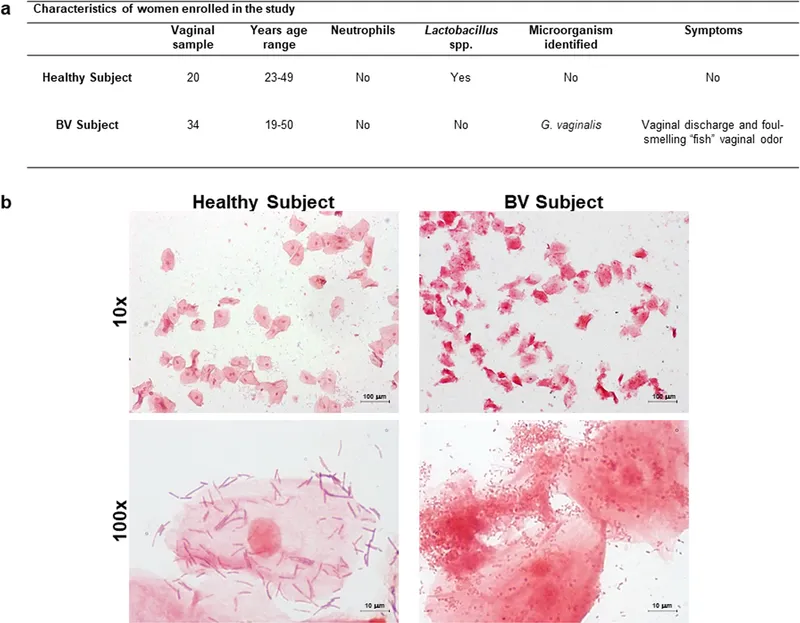 Vaginal Epithelial Cells: Healthy vs. Bacterial Vaginosis