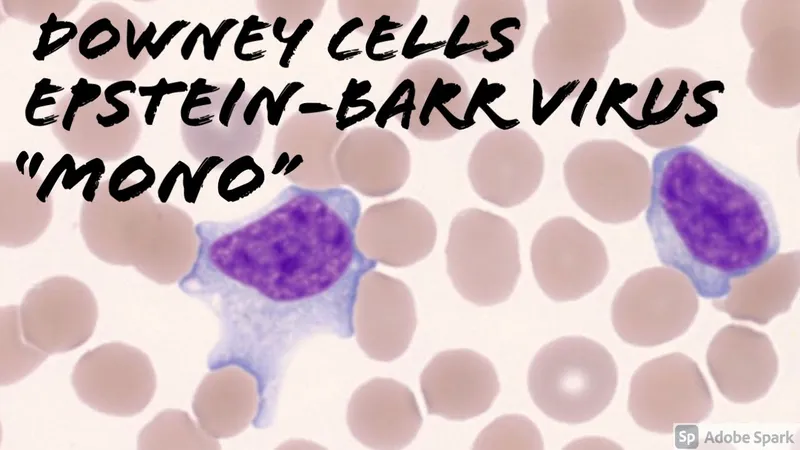 Downey cells in Epstein-Barr virus infection