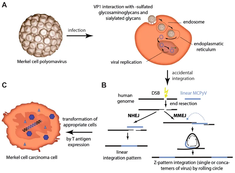 MCPyV infection, integration, and oncogenesis