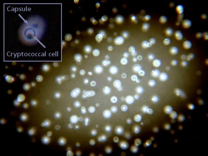 Cryptococcus neoformans India ink stain with capsule