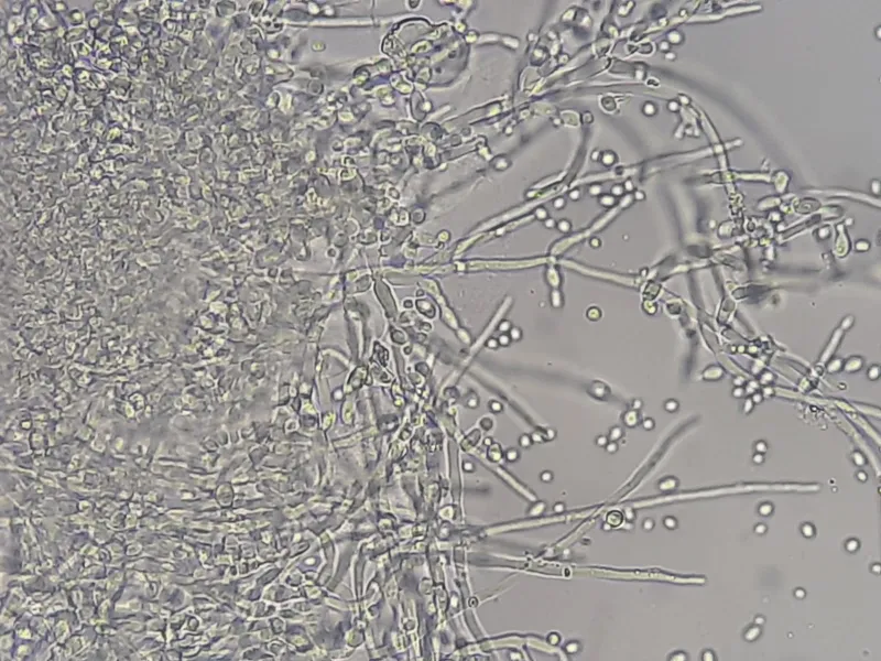 Candida albicans pseudohyphae and yeast cells, KOH prep