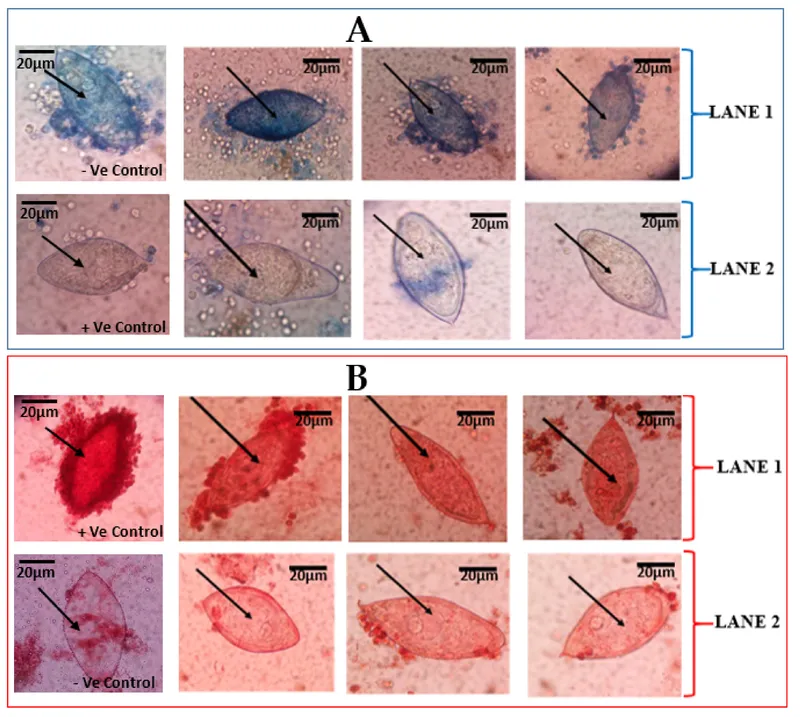 Schistosoma egg morphology and viability under microscopy