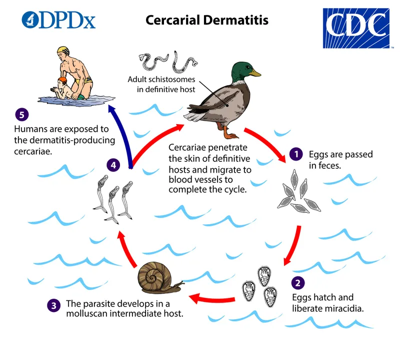 Cercarial Dermatitis Life Cycle