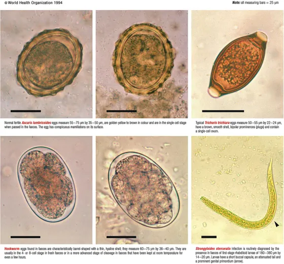 Microscopy of soil-transmitted helminth eggs and larva