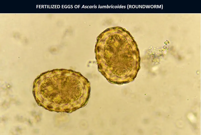 Fertilized Ascaris lumbricoides eggs