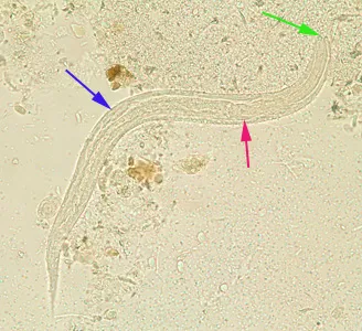 S. stercoralis rhabditiform larva