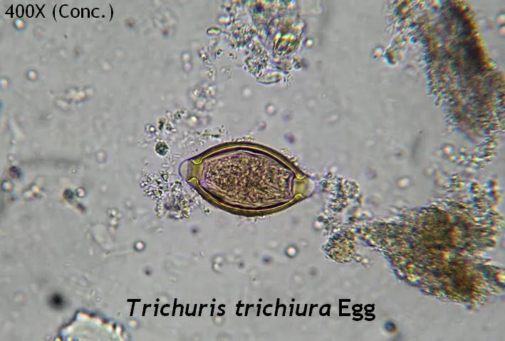 Trichuris trichiura egg
