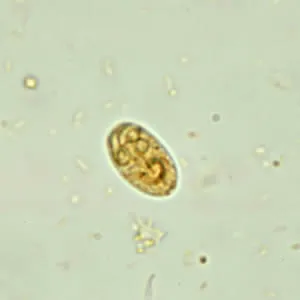Giardia lamblia cyst under microscope