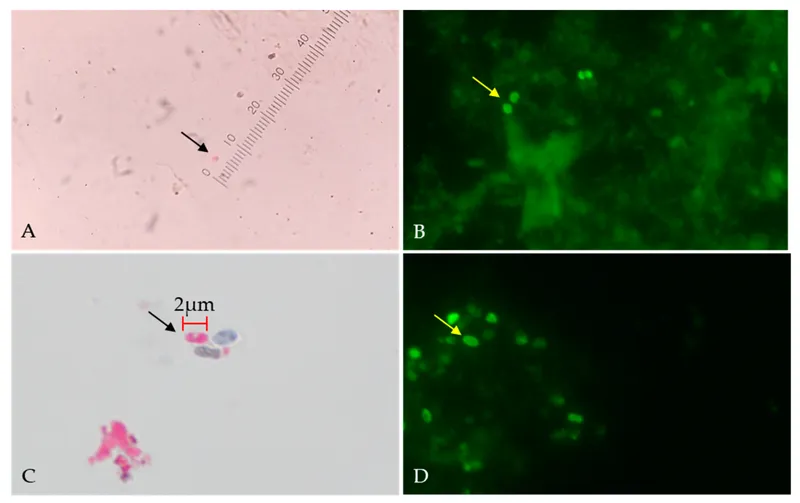 Microsporidia spores in stool, Chromotrope R and calcofluor