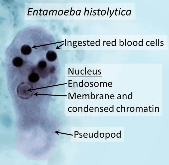Entamoeba histolytica trophozoite with ingested RBCs