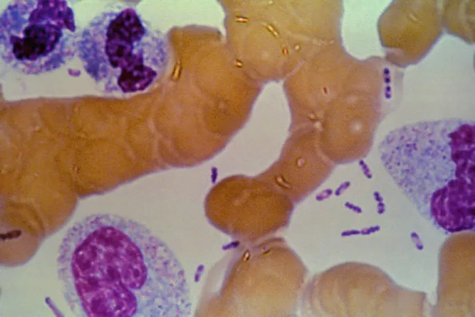 Yersinia pestis with bipolar staining