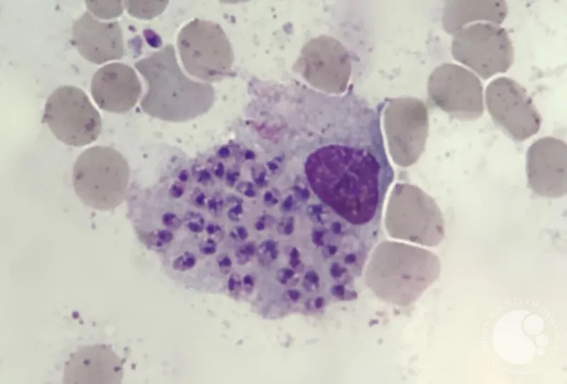 Leishmania amastigotes in macrophage, Giemsa stain