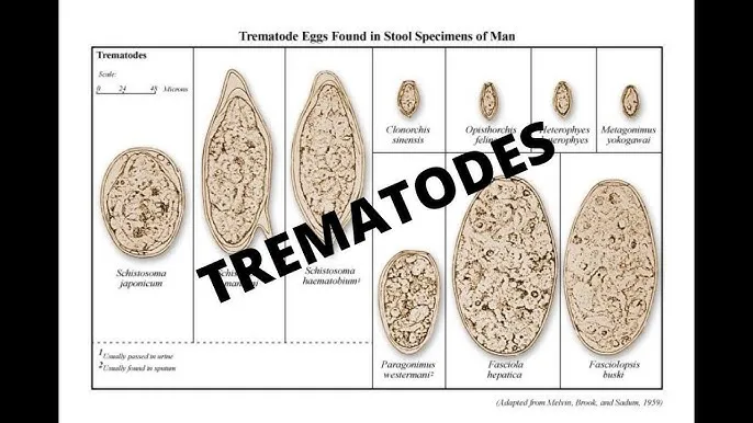 Trematode Eggs in Stool Specimens