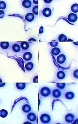 Trypanosoma cruzi trypomastigotes in blood smear