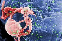 HIV virions budding from a lymphocyte
