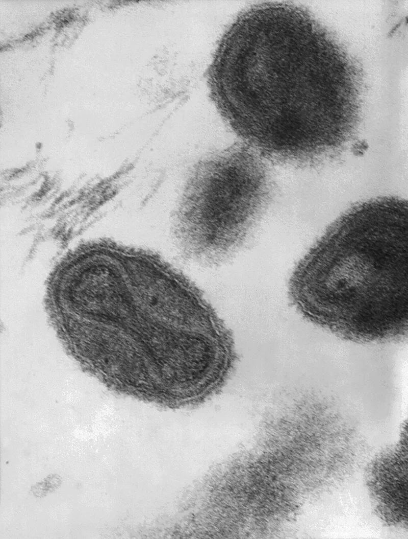 Poxvirus virion electron micrograph