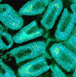 Rabies virus electron micrograph