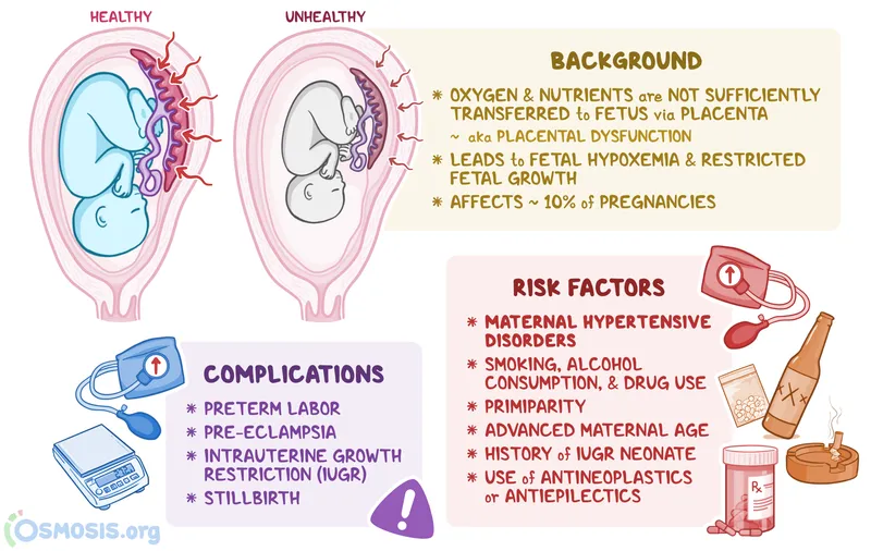 Placental Insufficiency & Fetal Growth Restriction