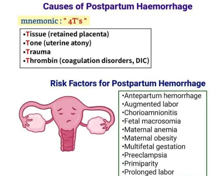 Causes and Risk Factors for Postpartum Hemorrhage