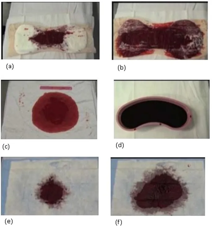 Visual aids for quantitative blood loss estimation