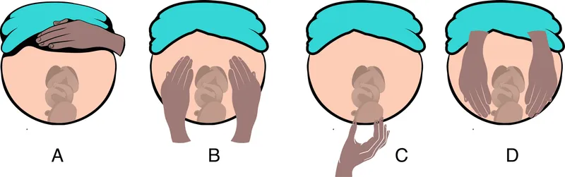 Leopold maneuvers for fetal assessment