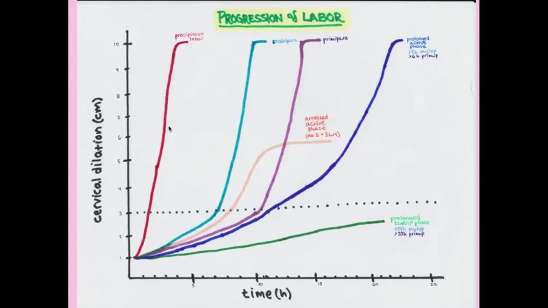 Labor curve showing protracted vs. arrested active phase