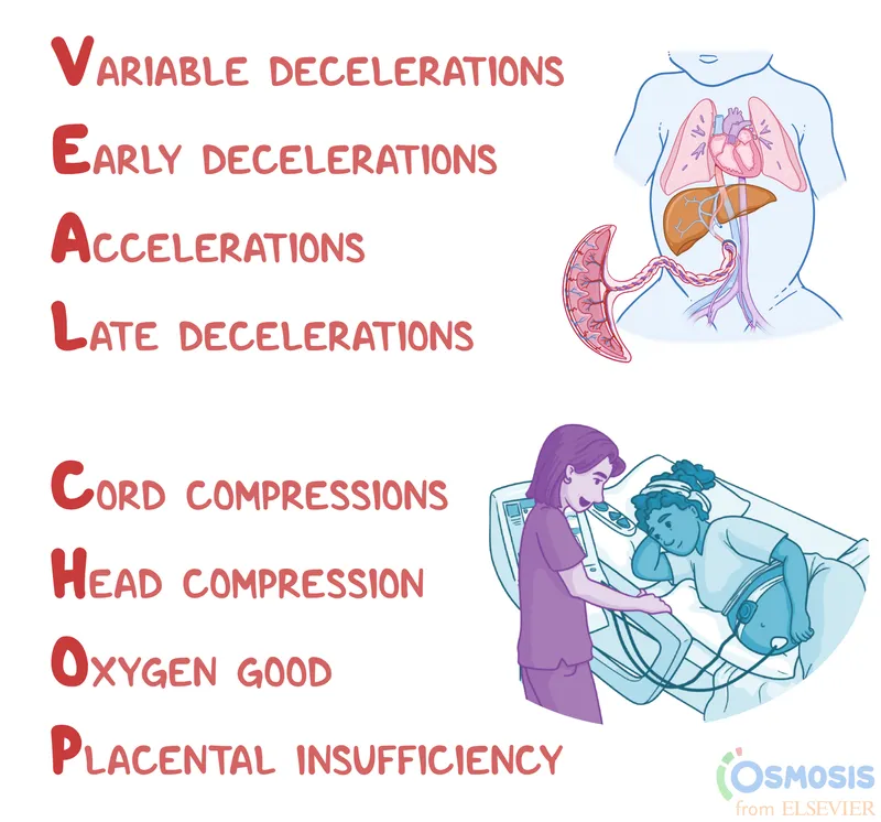 VEAL CHOP Mnemonic for Fetal Heart Rate Patterns