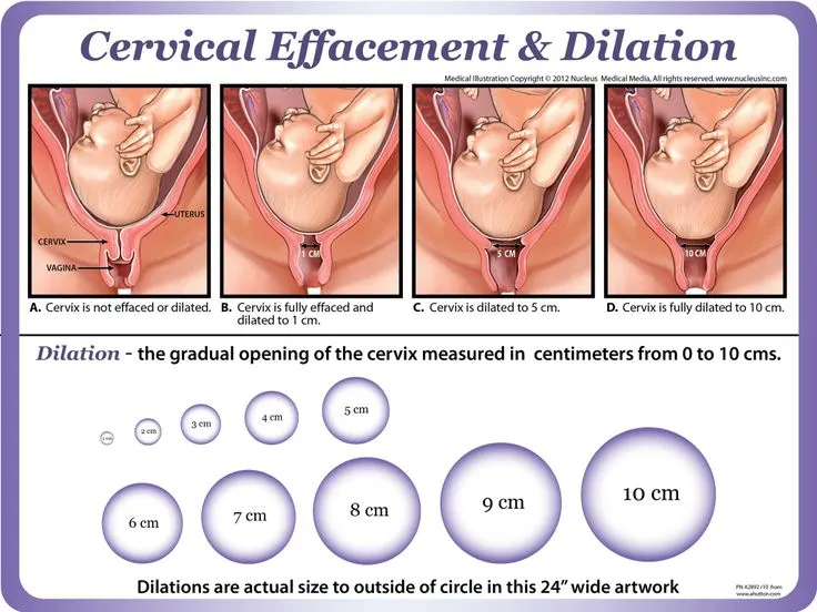 Cervical Effacement and Dilation (0-10 cm)